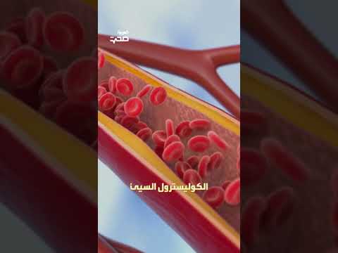 فوائد التمر معروفة ولكن ماذا عن الأضرار .؟