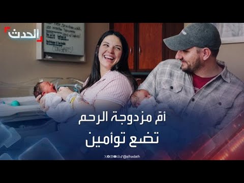 حالة نادرة.. أم برحم مزدوج تضع توأمين في يومين مختلفين