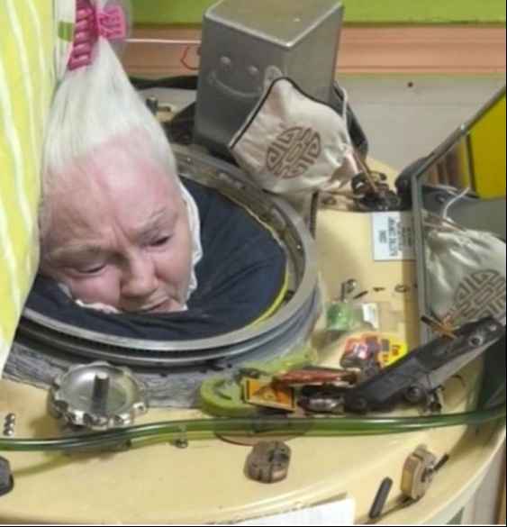 عاشت تتنفس بالرئة الحديدية أكثر من 70 عاماً.. وفاة "مارثا ليلارد" 4 3 1