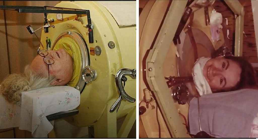 عاشت تتنفس بالرئة الحديدية أكثر من 70 عاماً.. وفاة "مارثا ليلارد" 1 43 1